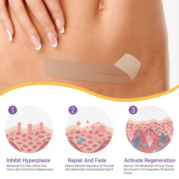 Skin Microneedle Repair Tape ~ Fade scars and stretch marks while you heal.