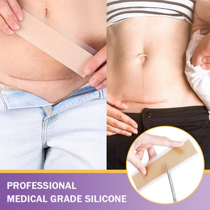 Skin Microneedle Repair Tape ~ Fade scars and stretch marks while you heal.